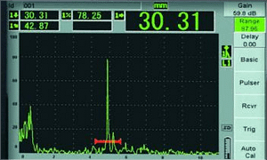 Regular ultrasound