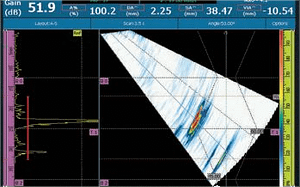 Phased array ultrasound